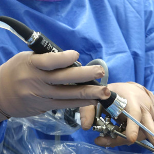 Ein minimalinvasiver chirurgischer Eingriff