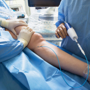 Eine phlebologische Operation